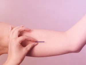 Implantable contraception