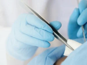 Birth control implant removal