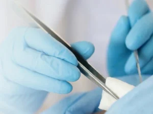 ถอนยาฝังคุมกำเนิด