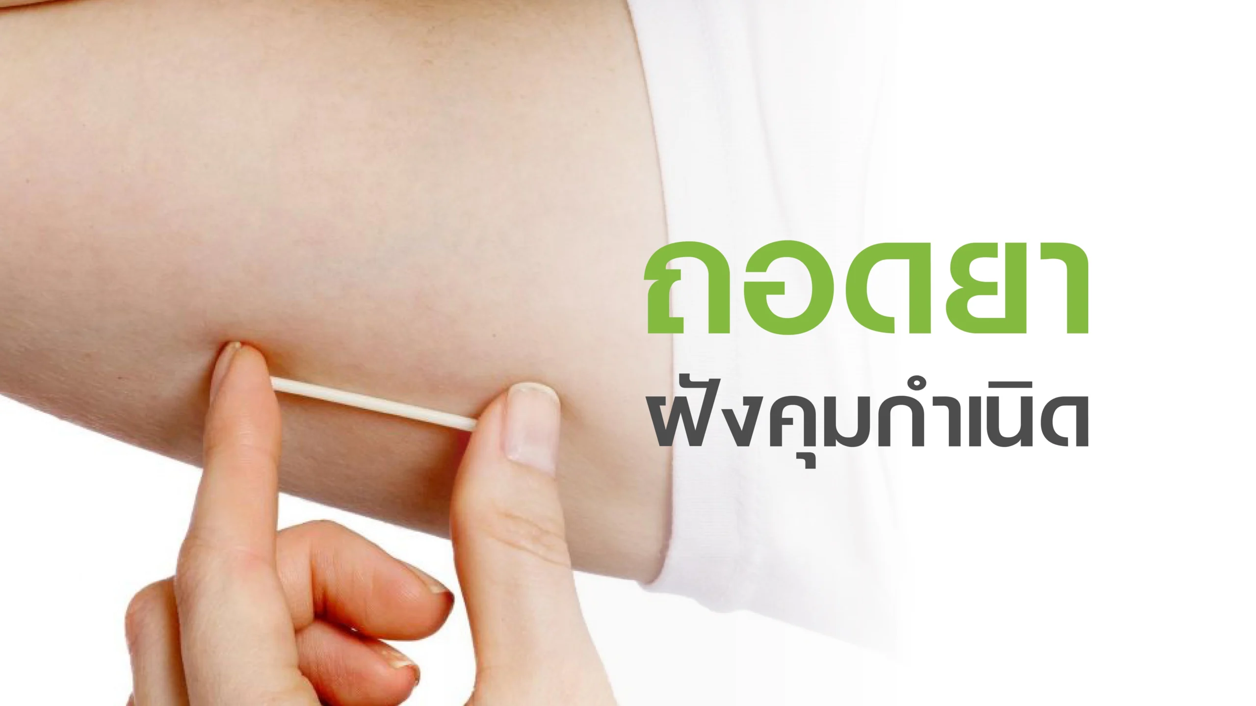 ถอนยาฝังคุมกำเนิด